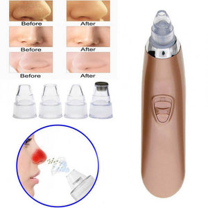 KICCY Blackheads Suction Machine, Electric Pore Cleaning Tool with Replaceable Heads