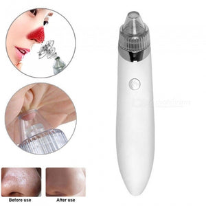 ZHAOYAO Handheld Electric Blackhead Acne Remover Facial Cleansing Instrument - White