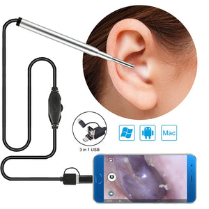 New 3.9mm Ear Spoon, USB Android Visible Ear Endoscope with 1.5m Cable